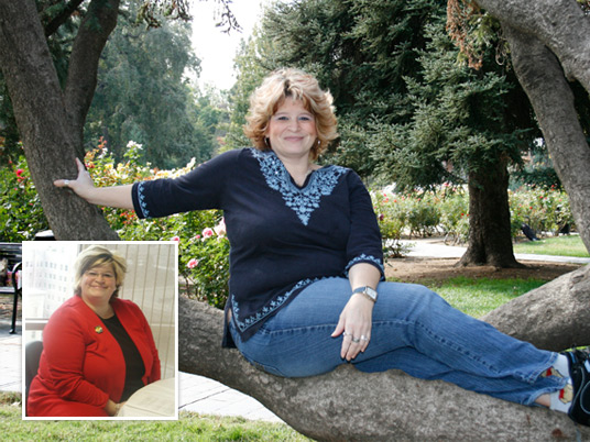 Wendy, Before and After Bariatric Surgery