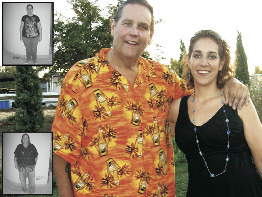 Marty and Rosalie, Before and After Bariatric Surgery