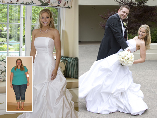 Brooke, Before and After Bariatric Surgery