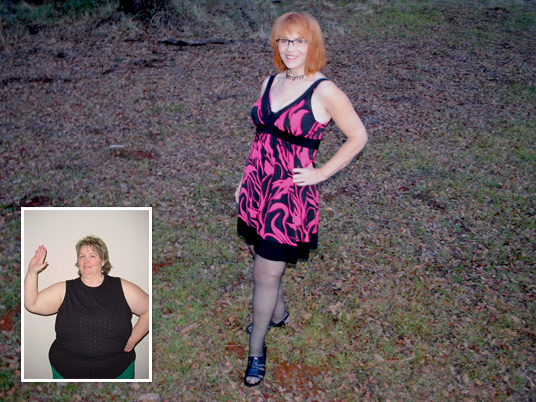 Christine, Before and After Bariatric Surgery