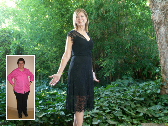 Marilyn, Before and After Bariatric Surgery