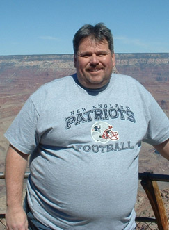 Richard, Before Weight Loss Surgery